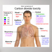 Hauptsymptome der Toxizität von Kohlendioxid Poster (Vorne)