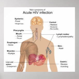 Hauptsymptome einer akuten HIV-Infektion Poster