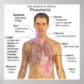 Hauptsymptome einer infektiösen Pneumonie Diagramm Poster (Vorne)