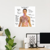 Hauptsymptome einer infektiösen Pneumonie Diagramm Poster (Heimbüro)