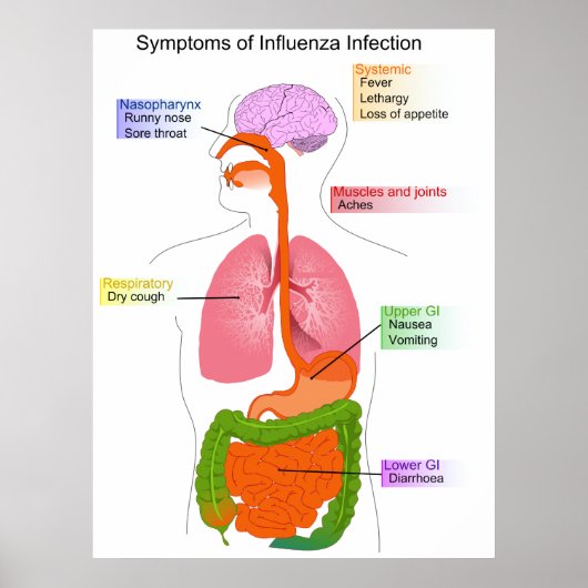 Hauptsymptome eines Influenza-Infektionsdiagramms Poster (Vorne)