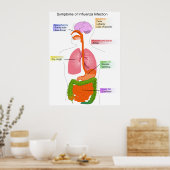 Hauptsymptome eines Influenza-Infektionsdiagramms Poster (Küche)