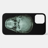 Head Skull X-Ray Case-Mate iPhone Hülle (Rückseite (Horizontal))