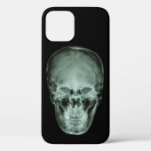 Head Skull X-Ray Case-Mate iPhone Hülle (Rückseite)
