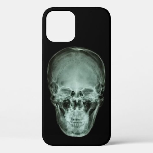 Head Skull X-Ray Case-Mate iPhone Hülle (Rückseite)