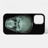 Head Skull X-Ray iPhone Hülle (Rückseite (Horizontal))