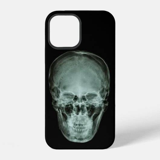 Head Skull X-Ray iPhone Hülle (Rückseite)