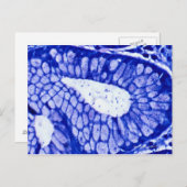 Helicobacter Pylori Postkarte (Vorne/Hinten)