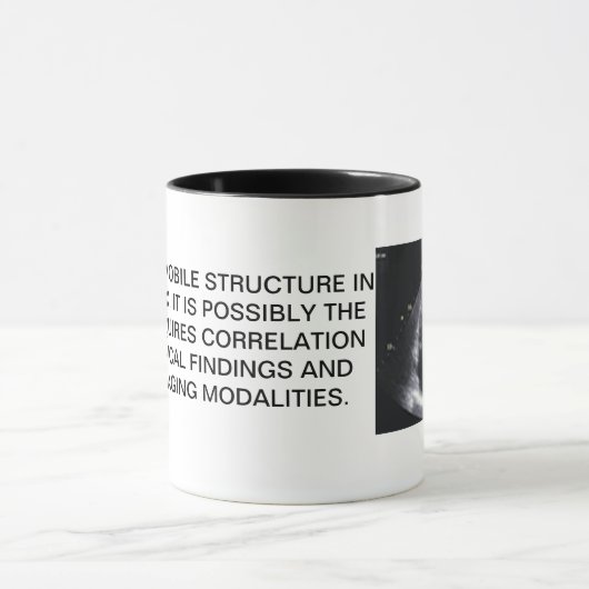 HERZecho-TASSE Tasse (Zentrum)