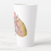 Herzerkrankung durch Carlos Machado Tasse (Vorderseite)