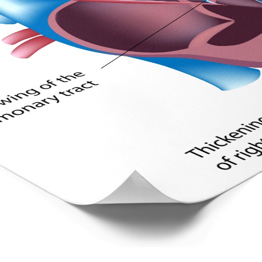 Herzerkrankung Poster (Ecke)