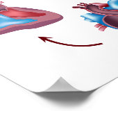 Herzklappen-Operation Poster (Ecke)