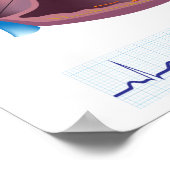 Herzkrankheit Vorhofflimmern Poster (Ecke)