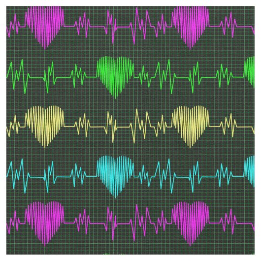 Herzrhythmus irisierendes EKG. Ärztin Stoff (Nahaufnahme)