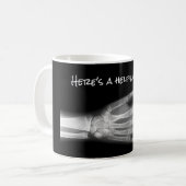 "Hier eine ist das Helfen Hand!" Handröntgenstrahl Kaffeetasse (Vorderseite Links)