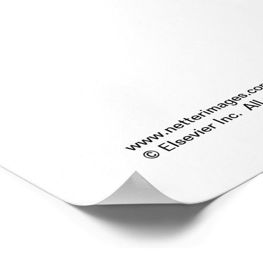 Hintere Bauchwand Poster (Ecke)