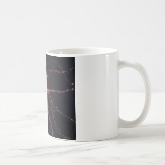 Hippocampal Neuronen 2 Kaffeetasse (Rechts)