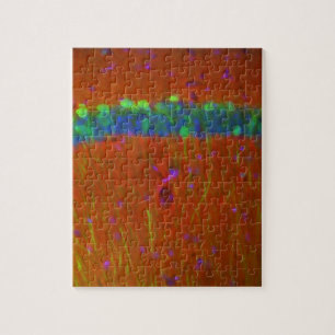 Hippocampal Neuronen 4 Puzzle