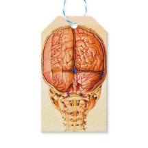 Hirnbasis und Meninges Lithograph