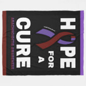 Hoffnung auf eine Heilung.. Arachnoiditis Fleecedecke (Vorderseite (Horizontal))