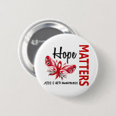 Hoffnung ist Schmetterling AIDS von Bedeutung Button (Vorne & Hinten)