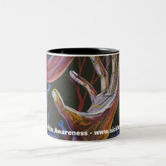 Hoffnung - Sichel-Zellen-Kunst Zweifarbige Tasse