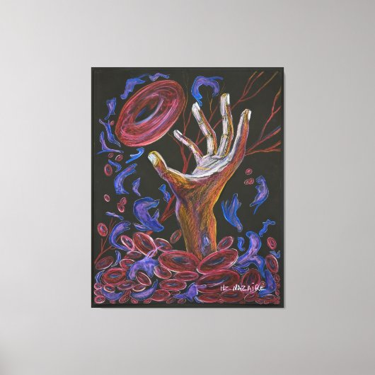 Hoffnung - Sichelzellschmerzen Bewusstsein Leinwanddruck (Vorderseite)