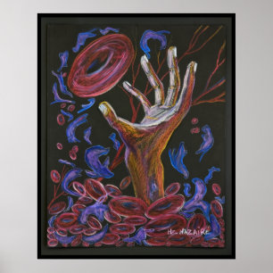 Hope - Sickle Cell Art Print Poster