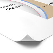 Hornhautgeschwüre Augenerkrankung Poster (Ecke)