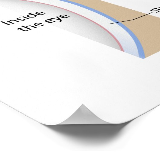 Hornhautgeschwüre Augenerkrankung Poster (Ecke)