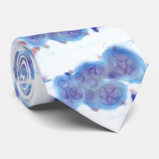 HSV Esophagitis - Bürste Krawatte (Gerollt)