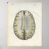 Human Brain Anatomy Print Poster (Vorne)