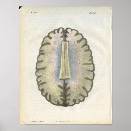 Human Brain Anatomy Print Poster (Vorne)