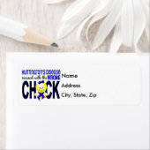 Huntingtons Krankheit mit falschem Kick (Insitu)