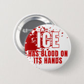 ICE ist Gestapo Anti Trump Button (Vorne & Hinten)