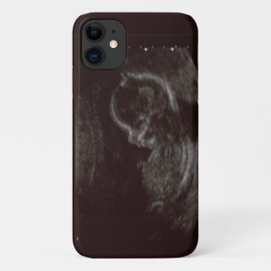 Ihr Babys Ultrasound Foto Case-Mate iPhone Hülle
