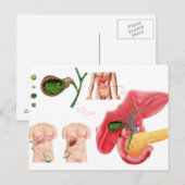 Illustration der Cholektomie Postkarte (Vorne/Hinten)