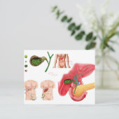 Illustration der Cholektomie Postkarte (Stehend Vorderseite)