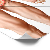 Illustration der Divertikulose im Kolon Poster (Ecke)