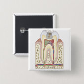 Illustration des Zahn-Zerfalls Button (Vorne & Hinten)
