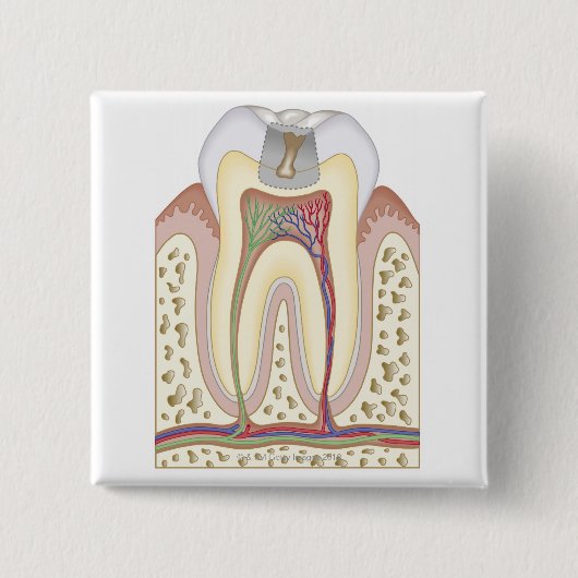 Illustration des Zahn-Zerfalls Button (Vorderseite)