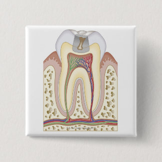 Illustration des Zahn-Zerfalls Button