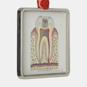 Illustration des Zahnverfalls Silbernes Ornament (Rechts)