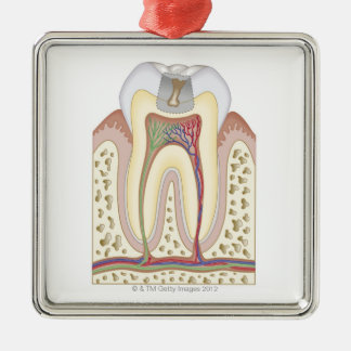 Illustration des Zahnverfalls Silbernes Ornament