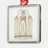 Illustration des Zahnverfalls Silbernes Ornament (Links)