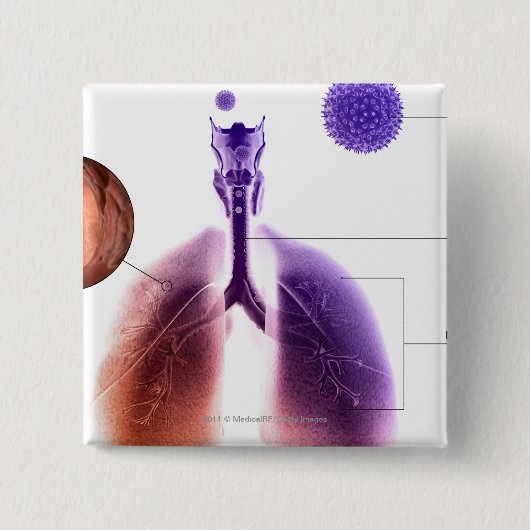 Illustration eines Asthmaanfalls vom Blütenstaub Button (Vorderseite)