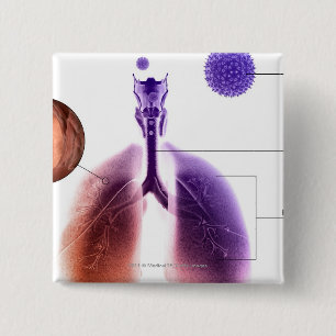 Illustration eines Asthmaanfalls vom Blütenstaub Button