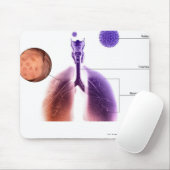 Illustration eines Asthmaanfalls vom Blütenstaub Mousepad (Mit Mouse)
