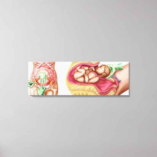 Illustration zur Darstellung der Lieferung von Föt Leinwanddruck (Vorderseite)