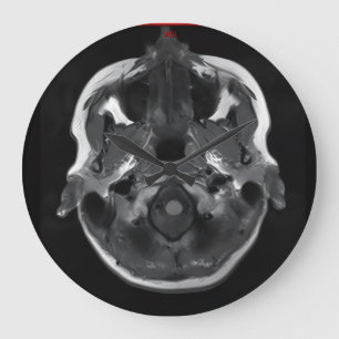 im Kopf xray mri scannen medizinisch Große Wanduhr